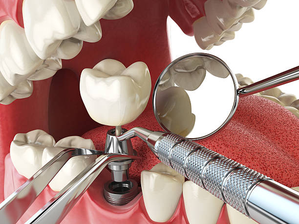 Best Tooth Infection Emergency Dentist  in USA